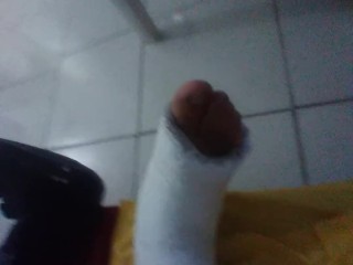 Pés engessados e pica espumando