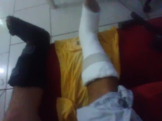 Pés engessados e pica espumando