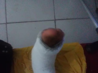 Pés engessados e pica espumando