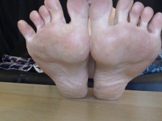 Winter Dry Crusty Feet Natural Soles