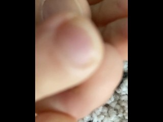 Extremely close view for my natural toenails